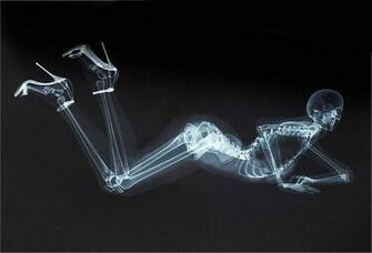 Xray Wallpaper