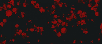Blood Spatter Background By Otterxsorrel