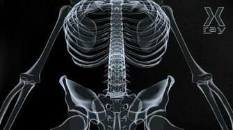 X Ray Wallpaper