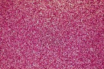 Showing Picture Black Glitter Background