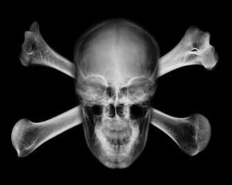 Ray Skull And Bones