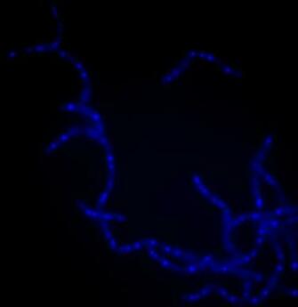 New Kind Of Antibiotic May Be More Effective Against Tuberculosis