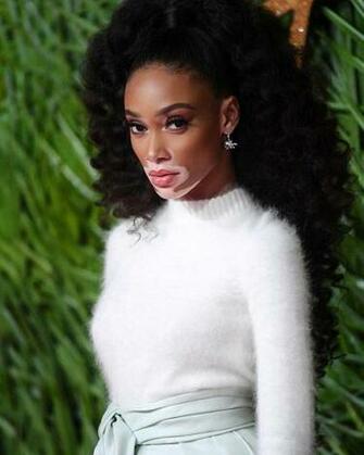 Winnie Harlow Bio Fitness Models Biography