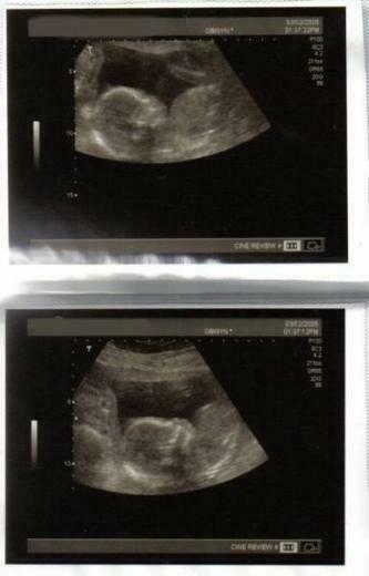 Wallpaper Pregnancy Countdown High Definition
