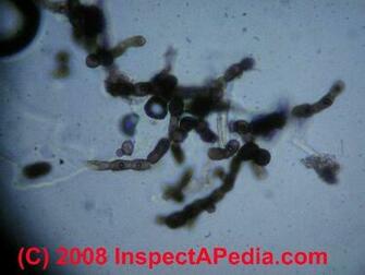 Mold Under Microscope