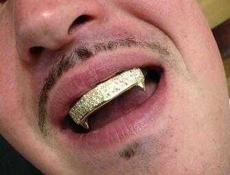 Top Rose Gold Grillz Fangs Wallpaper