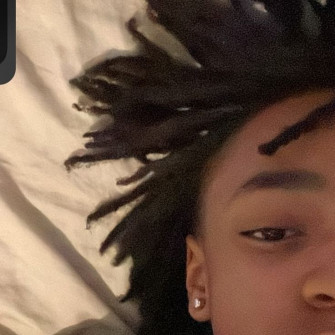 Eye