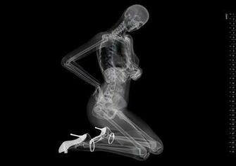 Neat Wallpaper X Ray Pin Up