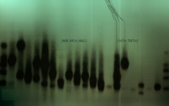 Teeth Nin Wallpaper White iPhone