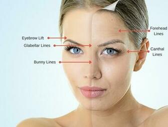 How A Dermatologist Can Make Wrinkles Fade