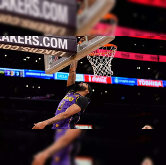 Davis American Nba Star Anthony To Undergo Mri After