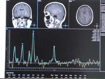 Best Neurosurgery Wallpaper