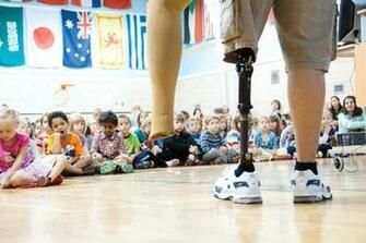 Gallery Terry Fox Prosthetic Leg