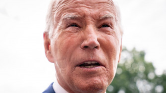 Odd Marks On Joe Biden S Face Shocked Ers What They Are