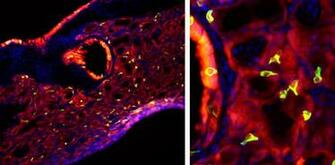 A Bad Bout Of Flu Triggers Taste Bud Cells To Grow In The Lungs