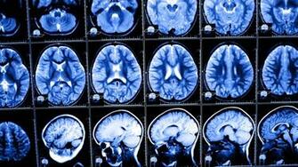 National Geographic To Show Brain Surgery Live On Tv