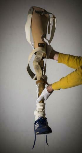 Gallery Terry Fox Prosthetic Leg