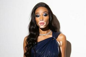Winnie Harlow Is The Amazonian Model To Join Victoria S