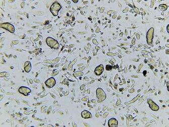 Science Source Symbiotic Protozoa In Termite Gut Lm