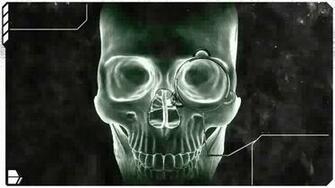 Human Skull X Ray Wallpaper