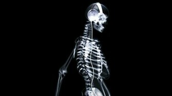 Headphones Music Wallpaper Xray