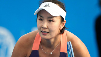 Close Up Shuai Peng Freckles L8i7uoogpp8ndnpy Wallpaper