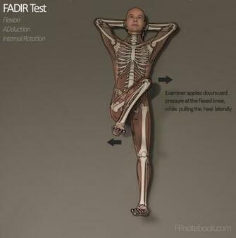 Hip Impingement Test Positive From Imgarcade