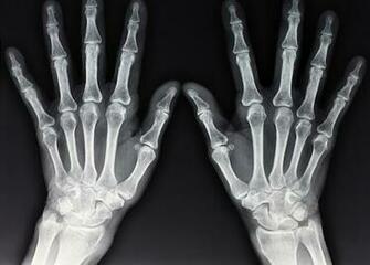 Ray Parsippany Nj Memorial Radiology Associates