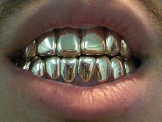 Fantastic Chicago Short Sale As Good Having Gold Teeth