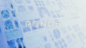 Medical Clinical Background Loop Video Clip