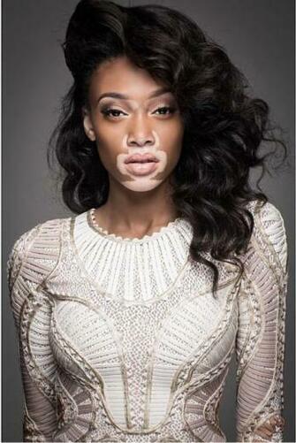 Beauty Comes In All Different Colors The Flawless Winnie Harlow