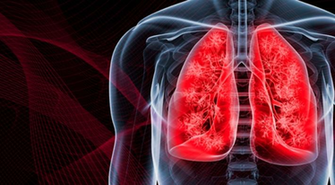 In Lung Cancer Research On April The Samuel Waxman