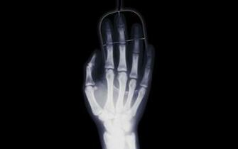 Hand On A Computer Mouse 8k Ultra HD Wallpaper Background Image