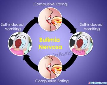 Bulimia Nervosa Recovery Steps And Tips To Cope With It