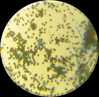 Black Mold Pictures Under The Microscopes Awareness