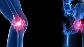 Orthopaedic Stem Lyfe Medical
