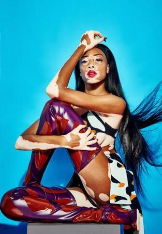 Beauty Crush Wednesdays Bcw Winnie Harlow Fashion Bomb Daily