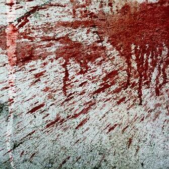 Blood Spatter A Photo On Iver
