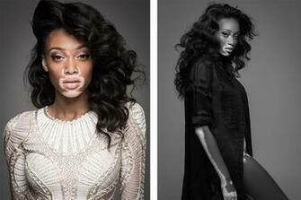 Winnie Harlow iPhone6 Wallpaper Windows Mode