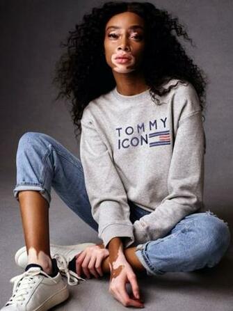 Winnie Harlow Photo Of Pics Wallpaper