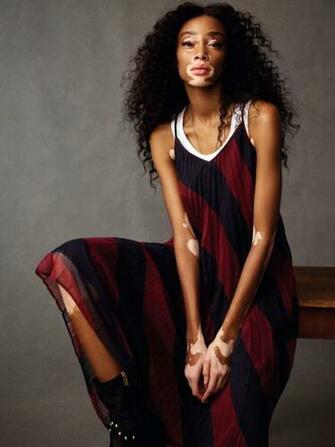 Winnie Harlow Photo Of Pics Wallpaper