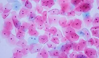 Genalice Oncology Accurate And Fast Tumor Analysis At Your