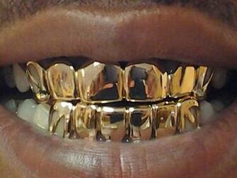 Teens Steal Gold To Make Grillz Complex