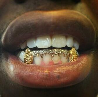 Two Tone Drips Sold As A Set Stl Grillzz