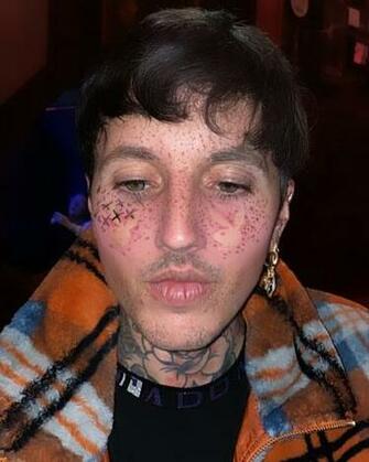 Oliver Sykes On Instagram I Ve Gone Mad Guys Ttyl With Image