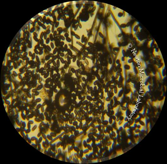 Black Mold Pictures Under The Microscopes Awareness
