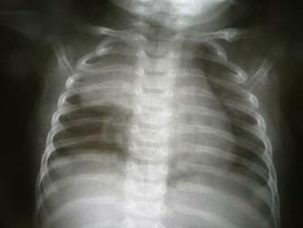 File Radiology Nevit Jpg