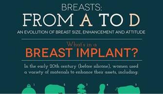 Related Wallpaper Teeth Implants Pros And Cons