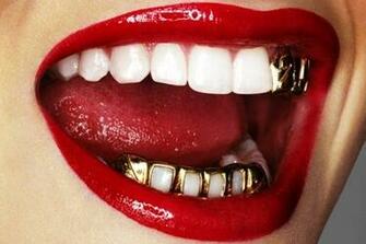 Gold Teeth