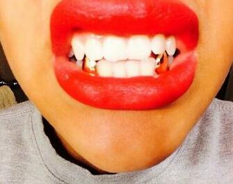 Top Rose Gold Grillz Fangs Wallpaper